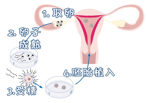 男性因素案例